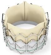 Illustration: The Sapien Transcatheter Heart Valve was approved by the FDA in 2011 for the treatment of severe aortic stenosis. –Edwards Lifesciences