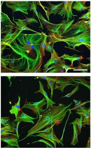 young and old cells