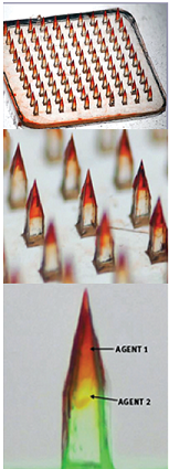 microneedles